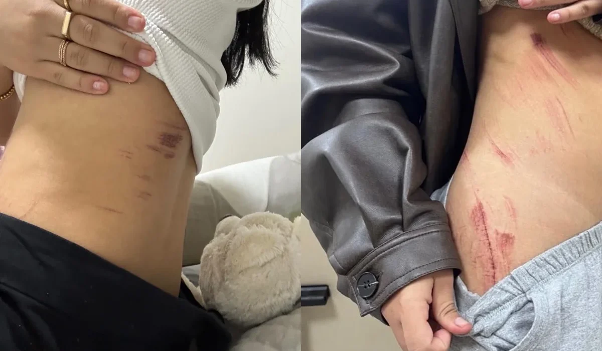 Casal Lésbico Relata Momentos de Terror Durante Estupro em Sobradinho