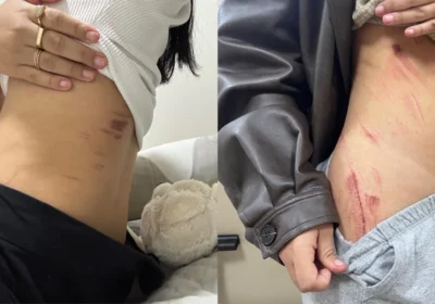 Casal Lésbico Relata Momentos de Terror Durante Estupro em Sobradinho